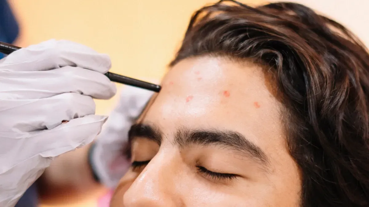 Waar wordt een haartransplantatiepen voornamelijk voor gebruikt?